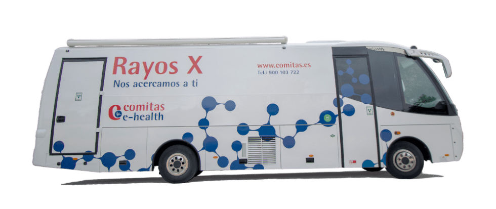 Unidad movil de rayos X y ecografía a domicilio